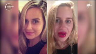 Tot mai mulţi tineri fac ABUZ de proceduri şi OPERAŢII ESTETICE! Psihologii trag un SEMNAL DE ALARMĂ şi spun că în spatele acestui fenomen se ascund alte PROBLEME