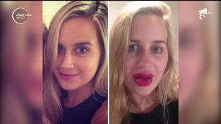 Implant de frumuseţe! Tinerii români sunt tot mai dependenţi de operaţii estetice