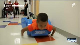 Un puşti din Statele Unite a avut nevoie de 9 operaţii pentru primul transplant de mâini reuşit, în lume