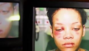 Chris Brown rupe tăcerea. Artistul a vorbit despre noaptea când a lovit-o pe Rihanna