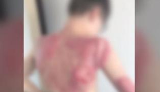 Un băieţel de 12 ani a suferit arsuri grave, în timp ce kartul în care se afla a fost cuprins de flăcări