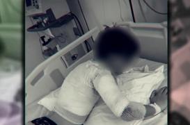 Un băiat de 12 ani a luat foc pe o pistă de karting din Ghimbav! Vina ar fi a patronului!