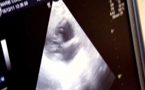 Copil viu în acte, mort la naştere! Familia unui bebeluş acuză medicii de la Bistriţa pentru moartea copilului lor