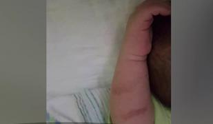 Bebeluş de doar trei săptămâni, învinețit de medici la ambele braţe! Au încercat să îi pună o branulă timp de 30 de minute!