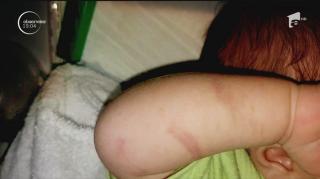 Acuzaţii grave la Cluj. Bebeluş umplut de vânătăi în spital. Ambii părinţi ar fi fost daţi afară din cabinet