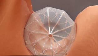 Medicina viitorului se practică şi în România! Operaţii pe inimă, fără bisturiu