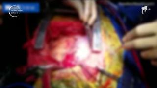 Un bărbat din India are două inimi care bat în acelaşi ritm, după o operaţie de urgenţă care i-a salvat viaţa