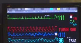 Oamenii care poartă pacemakere sunt vulnerabili în faţa hackerilor