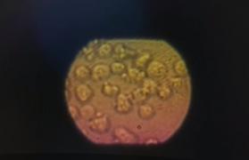 Un vaccin care ar putea vindeca mai multe cancere, incurabile până acum, intră în faza testelor pe oameni