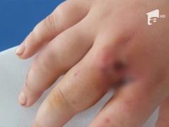 Maidanezii fac victime în Constanţa! Un copil a fost muşcat chiar în faţa blocului în care locuieşte