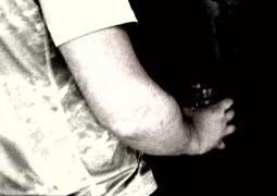 Detalii teribile după atacul cu acid de la Iaşi. Un bărbat riscă să rămână orb, după ce a deschis uşa unor necunoscuţi