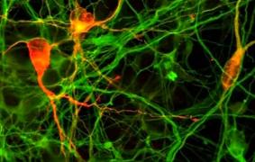 Cercetătorii japonezi le dau speranţe celor suferinzi de maladia Parkinson