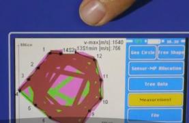 Un bistriţean a propus autorităţilor să cumpere un tomograf pentru copaci