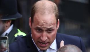 Prinţul William are o cicatrice foarte asemănătoare cu cea a lui Harry Potter