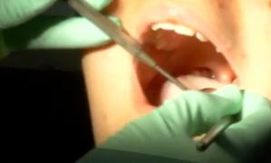 Primăria Capitalei le dă elevilor bani de stomatolog, cu o anumită condiţie