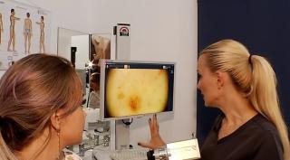 După o vară petrecută la soare este recomandată o vizită la dermatolog, pentru a investiga aluniţele