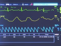 Medici sunt în alertă, tot mai multe femei ajung bete criță la Urgențe