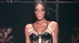Fotomodelul cu vitiligo, Winnie Harlow, a cucerit lumea internaţională a modei