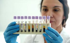 Cancerul la sân ar putea fi depistat prin analize de sânge, spun medicii germani