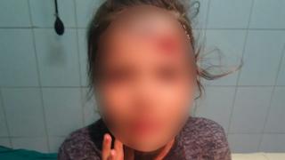 Fetiţa din Călăraşi, aproape leşinată după ce fost lovită cu borcanul de bulion în cap. "Mami, îmi vine să vomit!" (Video)