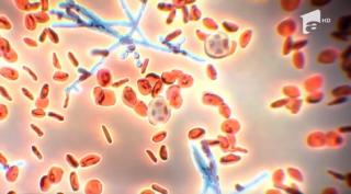 O nouă infecţie periculoasă a ajuns în Statele Unite. Aproape jumătate din pacienţii infectaţi mor în 90 de zile