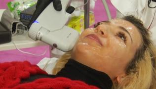 Tratamentul cu oxigen, o gură de aer pentru piele