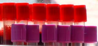 Donatorii de sânge, invitaţi să doneze în centre care se prăbuşesc