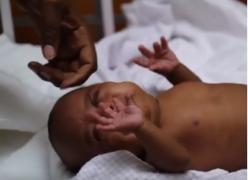 Cel mai mic copil din lume a sfidat moartea