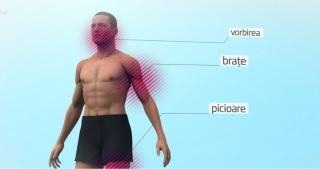 Sănătate, România. Patru români mor, în fiecare oră, în urma unui accident vascular cerebral