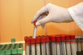 Programul naţional pentru tratarea hepatitei C, extins din toamnă