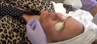 Terapia-vampir, secretul reîntineririi. Româncele încep să devină din ce în ce mai preocupate de propriul aspect