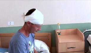 Tânărul împuşcat accidental în Gorj, de la doi kilometri, povesteşte trauma prin care a trecut