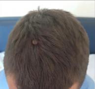 Plângere penală pentru mutarea poligonului de trageri din Târgu Cărbuneşti, după ce un tânăr a fost lovit în cap de un glonţ rătăcit