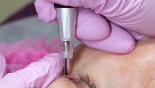 Tânără din Iaşi, la un pas să-şi piardă vederea din cauza unui tatuaj