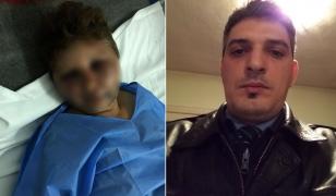 Femeie desfigurată în bătaie de un polițist din Olt: 'A zis că mă îngroapă în curte'