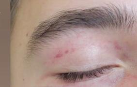 Un băiat de 13 ani a ajuns la spital desfigurat de tatăl său, din cauza notelor de la şcoală, în Timişoara