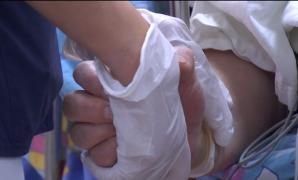 Greşeli în lanţ au dus la incendierea unei femei pe masa de operaţie la Floreasca