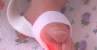 România, pe primul loc în Uniunea Europeană la mortalitate infantilă