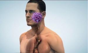 Infecţia cu noul coronavirus poate afecta, pe rând, plămânii, inima, rinichii și intestinul (Video)