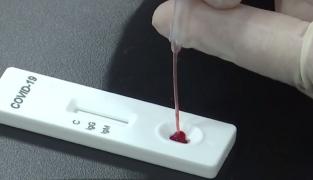 OMS: faceți teste fiecărui suspect