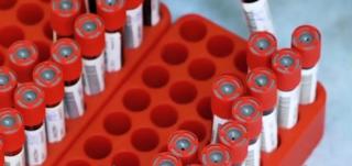 Un specialist american atrage atenția că numărul infectărilor cu coronavirus ar putea fi mult mai mare