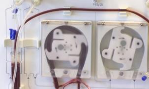 Centrele de dializă, puncte sensibile în lupta cu noul coronavirus