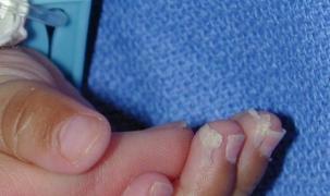 Noi simptome de coronavirus la copii, raportate de medicii din SUA