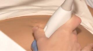 Întreruperea de sarcină, o intervenţie greu accesibilă în timpul pandemiei (Video)