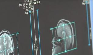 Pacienții pozitivi cu COVID nu pot face investigaţii RMN