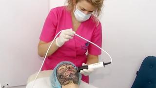 Tratamente de îngrijire pe timp de vară, recomandate de medicii dermatologi