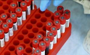 Soţia unui tânăr internat în spital, cu coronavirus: "Pentru testul de la Matei Balş, nici până în ziua de azi nu l-a sunat nimeni. La privat, în 3 zile" (Video)