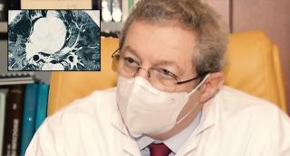 SARS-CoV-2 atacă nemilos. Plămâni făcuți ca șvaițerul, organe grav afectate: Streinu-Cercel: "Atâtea tragedii şi drame nu am văzut aproape în toată cariera mea"