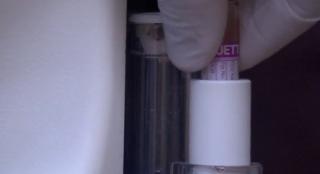 Managerii de spitale care nu raportează corect cazurile de infecţii nosocomiale ar putea fi traşi la răspundere de anul viitor