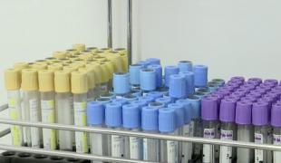 Experiment Observator: când se formează de fapt imunitatea după a doua doză de vaccin